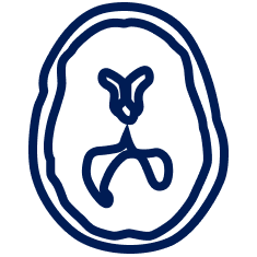 Colloid Cyst Treatment